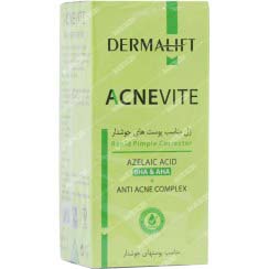 ژل ضد جوش اورژانسی آکنویت